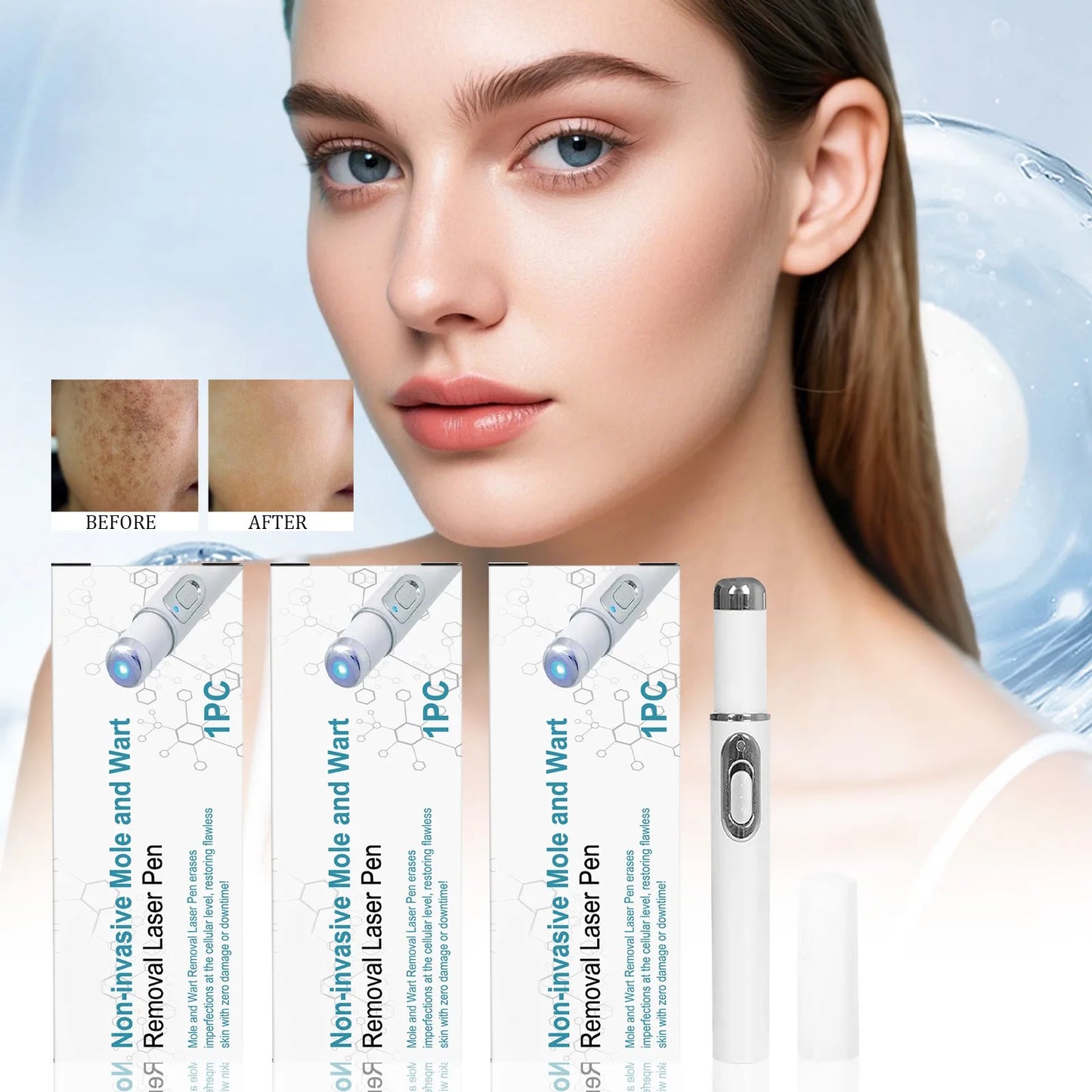 Blue Light Mole Removal Pen for Face & Body - Painless Non-Invasive Wart Pigmentation Treatment Tool, Skin Blemish Corrector
